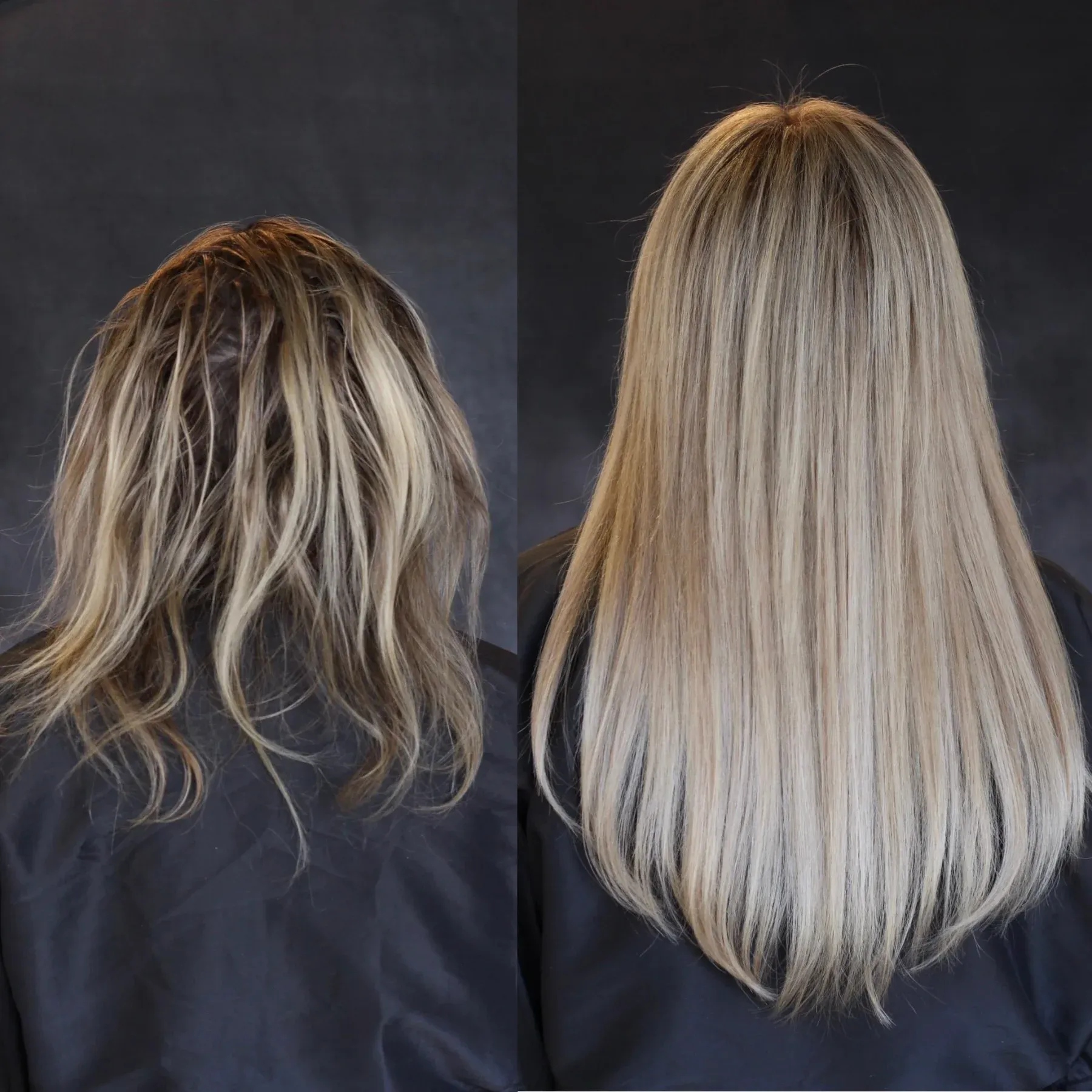 GLP-1s and Hair Loss: What Your Stylist Wants You to Know